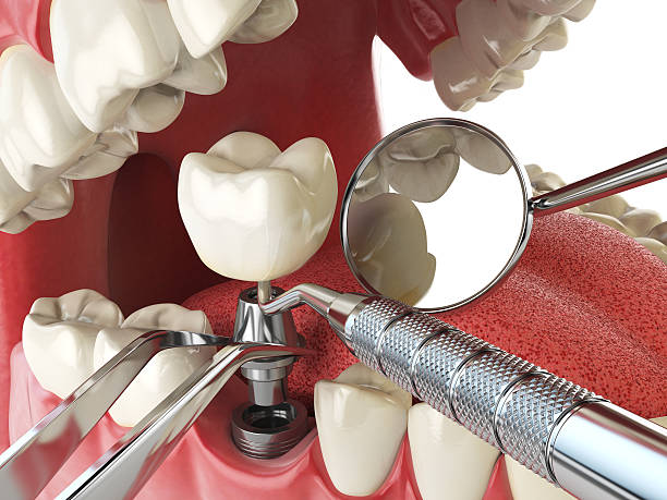 Best Emergency Dentist for Knocked-Out Tooth in Shannon, MS